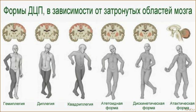 Изучаем формы детского дизайна: как создать уютную и креативную обстановку для малышей